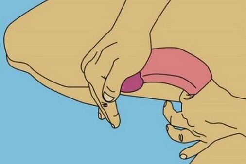 Bending the penis to enlarge the head