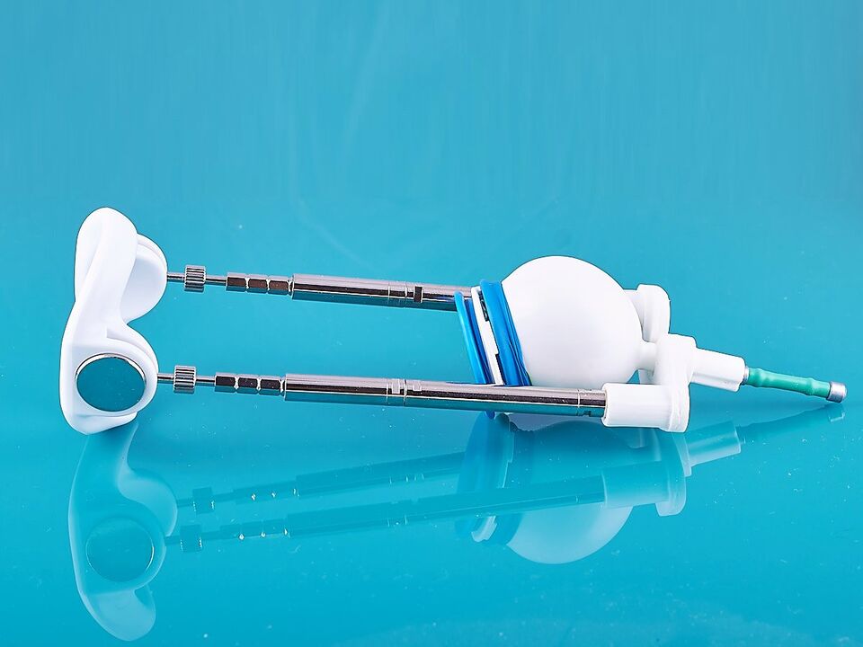 The extender helps to improve the outcome of the ligamentotomy