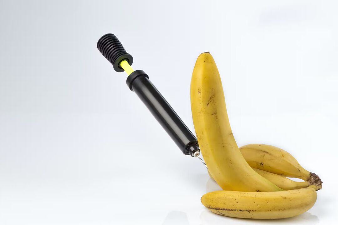 Lipofilling – penis enlargement by injecting fatty tissue