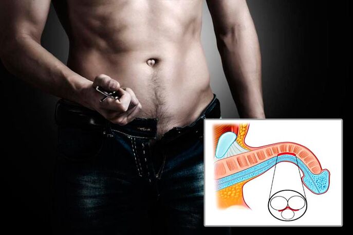 Man opens his fly for penis enlargement exercises