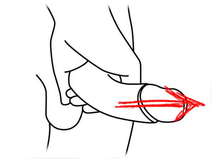 Stretching the penis for enlargement